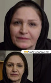 کرم لیفتینگ پوست 120میل لاکچری کویین
