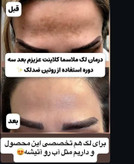 کرم ضد لک لاکچری کویین