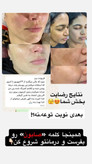 کرم ضد لک لاکچری کویین