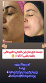 کرم ضد لک لاکچری کویین