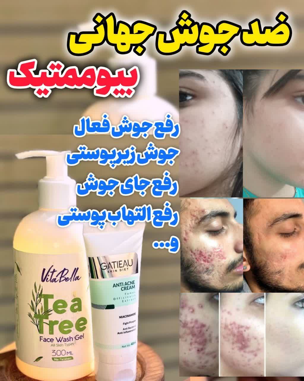 کرم ژل آکنه ضد جوش و ضد لک گاتیو 40میل