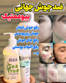 کرم ژل آکنه ضد جوش و ضد لک گاتیو 40میل