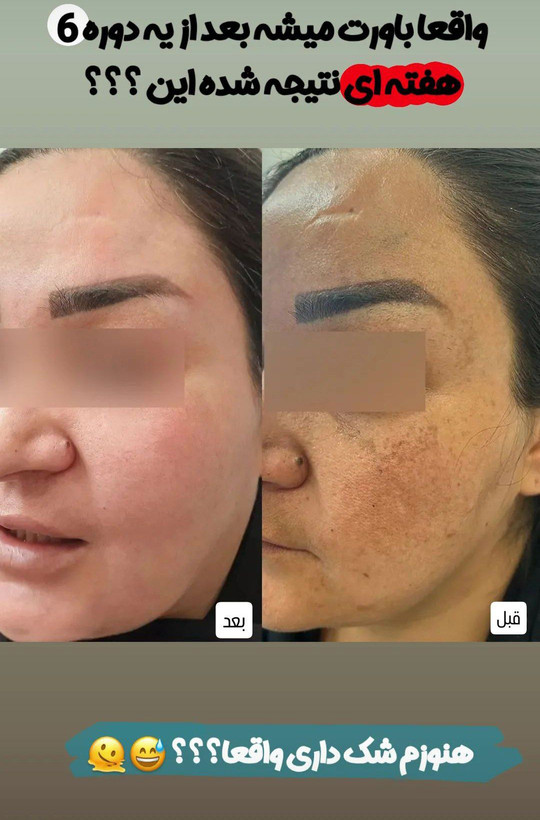 صابون روشن کننده و لایه بردار پک سه عددی